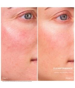 BABOR Doctor Babor Herbal Balancing Toner Gesichtswasser -Babor babor doctor babor herbal balancing toner gesichtswasser 200 ml 4015165358985 visual2